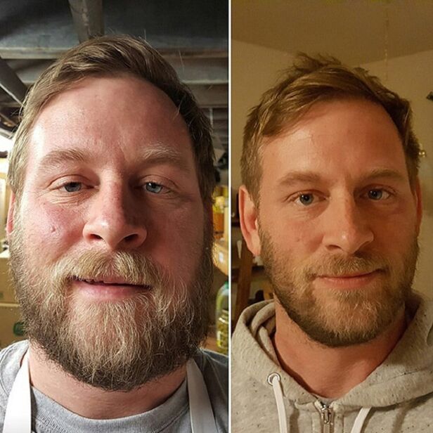 vzhled osoby před a po opuštění alkoholu